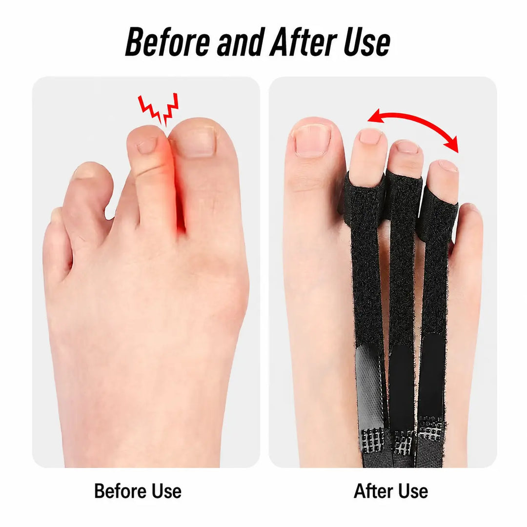 Adjustable Toe Separator Support