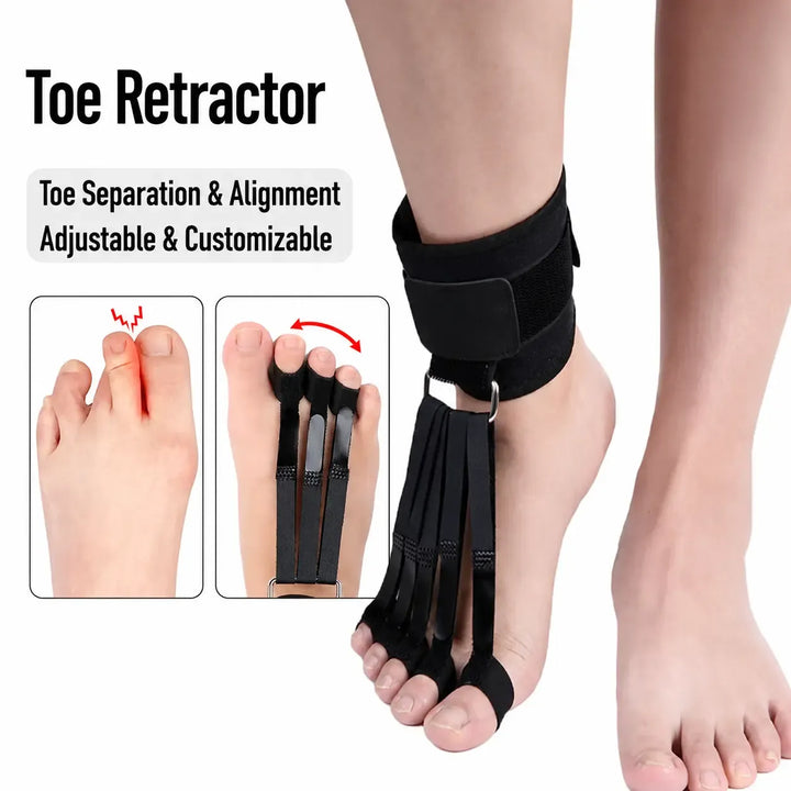 Adjustable Toe Separator Support
