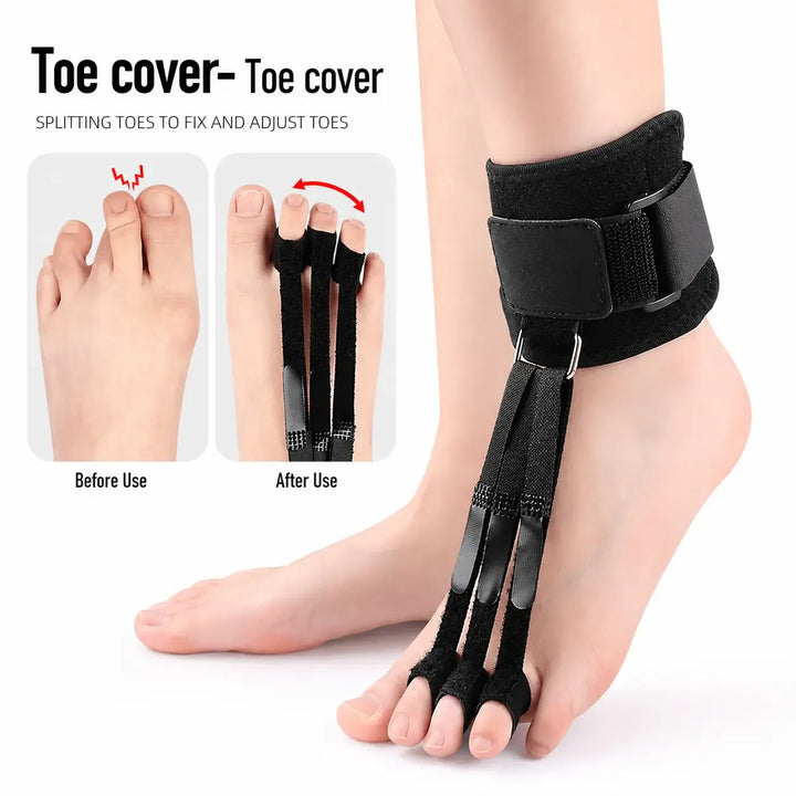 Adjustable Toe Separator Support
